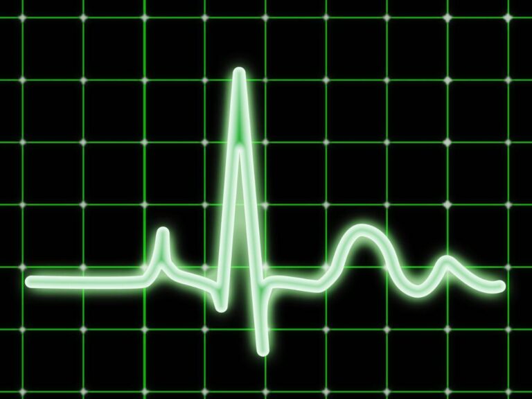 Zapis tętna. Obrazek w artykule Prawidłowe tętno. Jakie są normy i jak monitorować ciśnienie tętnicze?