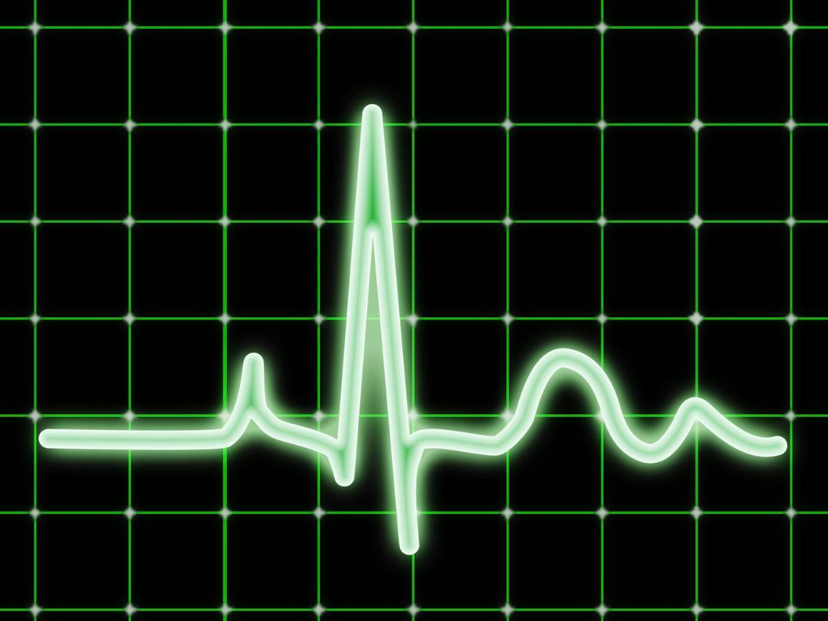 Zapis tętna. Obrazek w artykule Prawidłowe tętno. Jakie są normy i jak monitorować ciśnienie tętnicze?